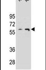 THUMPD3 Antibody in Western Blot (WB)