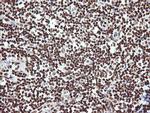 THUMPD1 Antibody in Immunohistochemistry (Paraffin) (IHC (P))