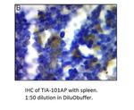 TIA1 Antibody in Immunohistochemistry (IHC)