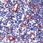 TIE1 Antibody in Immunohistochemistry (Paraffin) (IHC (P))