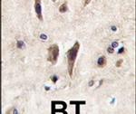 TIE1 Antibody in Immunohistochemistry (IHC)