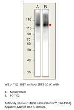 TIE2 Polyclonal Antibody