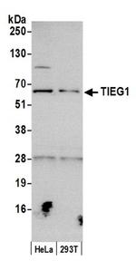 TIEG1 Antibody in Western Blot (WB)