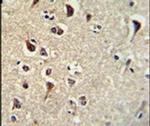 KLF11 Antibody in Immunohistochemistry (IHC)