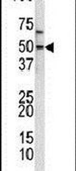 KLF11 Antibody in Western Blot (WB)