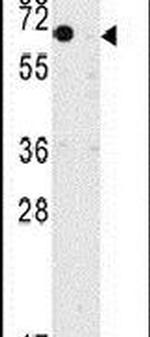 KLF10 Antibody in Western Blot (WB)