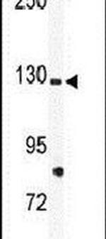 TIE1 Antibody in Western Blot (WB)