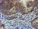 TIGD1 Antibody in Immunohistochemistry (Paraffin) (IHC (P))