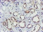 TIGD1 Antibody in Immunohistochemistry (Paraffin) (IHC (P))