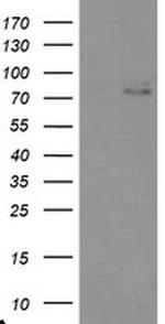 TIGD1 Antibody in Western Blot (WB)