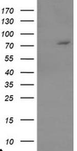 TIGD1 Antibody in Western Blot (WB)