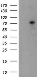 TIGD1 Antibody in Western Blot (WB)
