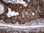 TIMM8A Antibody in Immunohistochemistry (Paraffin) (IHC (P))