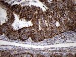 TIMM8A Antibody in Immunohistochemistry (Paraffin) (IHC (P))