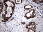 TIMM8A Antibody in Immunohistochemistry (Paraffin) (IHC (P))