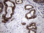TIMM8A Antibody in Immunohistochemistry (Paraffin) (IHC (P))