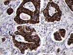 TIMM8A Antibody in Immunohistochemistry (Paraffin) (IHC (P))