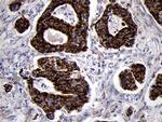 TIMM8A Antibody in Immunohistochemistry (Paraffin) (IHC (P))