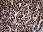 TIMM8A Antibody in Immunohistochemistry (Paraffin) (IHC (P))