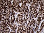 TIMM8A Antibody in Immunohistochemistry (Paraffin) (IHC (P))