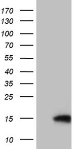 TIMM8A Antibody in Western Blot (WB)