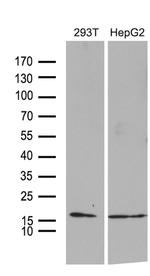 TIMM8A Antibody in Western Blot (WB)