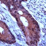 TIMP1 Antibody in Immunohistochemistry (IHC)