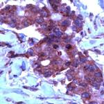 TIMP2 Antibody in Immunohistochemistry (IHC)