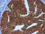 TIMP2 Antibody in Immunohistochemistry (Paraffin) (IHC (P))