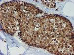 TIMP2 Antibody in Immunohistochemistry (Paraffin) (IHC (P))
