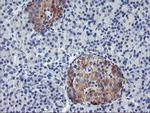 TIMP2 Antibody in Immunohistochemistry (Paraffin) (IHC (P))