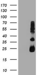 TIMP2 Antibody in Western Blot (WB)
