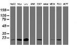 TIMP2 Antibody in Western Blot (WB)