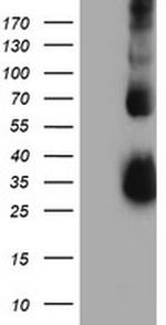 TIMP2 Antibody in Western Blot (WB)