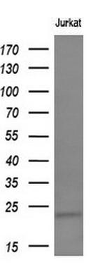 TIMP2 Antibody in Western Blot (WB)