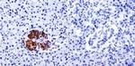 TIMP2 Antibody in Immunohistochemistry (Paraffin) (IHC (P))