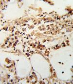 TIMP3 Antibody in Immunohistochemistry (IHC)