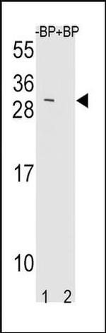 TIMP3 Antibody in Western Blot (WB)