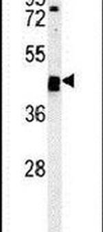 TINAGL1 Antibody in Western Blot (WB)