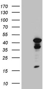 TINF2 Antibody in Western Blot (WB)