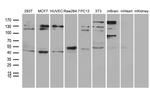 TINF2 Antibody in Western Blot (WB)