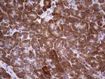 TIPIN Antibody in Immunohistochemistry (Paraffin) (IHC (P))