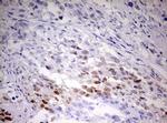 TIPIN Antibody in Immunohistochemistry (Paraffin) (IHC (P))