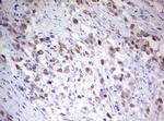 TIPIN Antibody in Immunohistochemistry (Paraffin) (IHC (P))