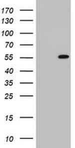 TIPIN Antibody in Western Blot (WB)