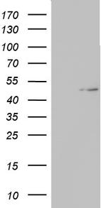 TIPIN Antibody in Western Blot (WB)