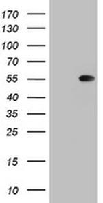 TIPIN Antibody in Western Blot (WB)