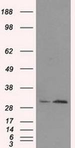 TIPRL Antibody in Western Blot (WB)