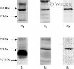 ATP1A3 Antibody in Western Blot (WB)