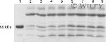 Estrogen Receptor beta Antibody in Western Blot (WB)
